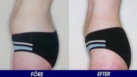 Lipolys före och efter