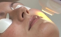 ipl-photorejuvenation