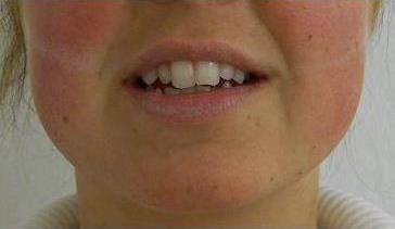 lypolis före hamsterkinder